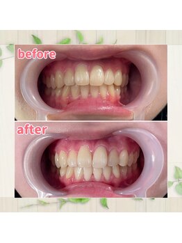 パルティービューティー 天満店(PARTIE BEAUTY)/お客様の変化をお届け【No.1】