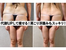 スリーピングビューティー(Sleeping Beauty)の雰囲気（代謝UPして痩せる！肩コリ浮腫みもスッキリ！本気のインディバ！）