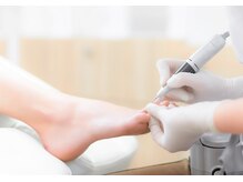 ウムラウト(Umlaut)/施術