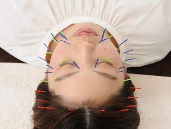 やけの鍼灸整骨院/美容鍼