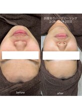 タグ 高知駅前店(Tug)/【お肌の毛穴・ニキビケア】