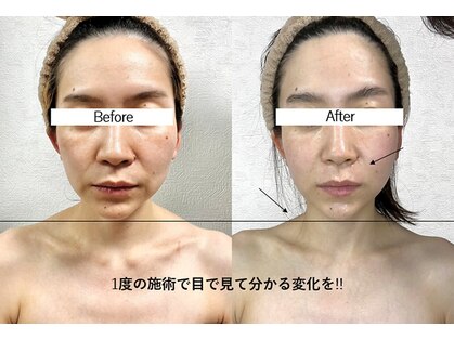 ソフィームの写真
