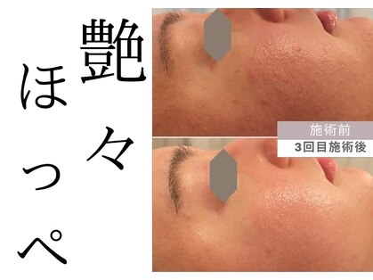 チッチ アフロディーテ(Chicchi Aphrodit)の写真