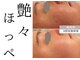 チッチ アフロディーテ(Chicchi Aphrodit)の写真
