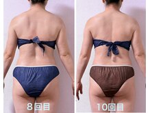 サロン アモル(salon amor)/インディバで背中スッキリ