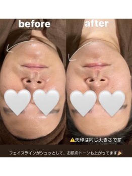 ウォームメモリー(warmmemory)/フェイシャルエステ