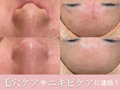 ミュー 栄本店(mieux)の写真