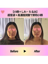 ミサ/フェイシャルエステ