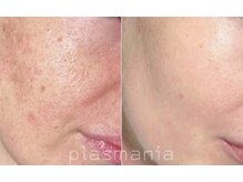 エフェクト 塚口店(effect)/Before After