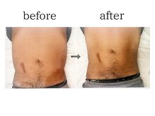 デサフィオ(Desafio)/お腹before→after