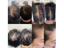 ラストミニットサロン 東京の雰囲気（プロセルで頭皮環境整えてあの頃の頭皮へ☆まずは相談）