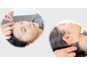 【面長顔の悩み】人中短縮特化型幹細胞パック美容鍼120分 ¥26,500円