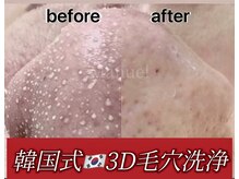 マニュエル(Manuel)の雰囲気（戸塚エリア初！！驚くほど浮き出る韓国式3D毛穴洗浄導入！！）