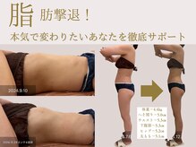 パルタージュ(Partage)の雰囲気（身体の状態に合わせた施術で最短で結果出し！凸凹セルケア/痩身）