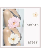 ビューティフィール アンド アリサナ(Beauty Feel&Arisana)/症例写真　バストケア