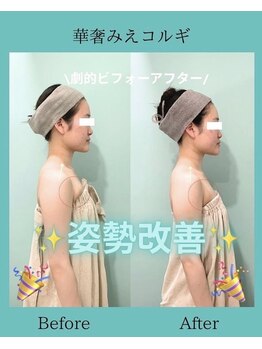 アコガレコガオ 鳥取店/コルギのビフォーアフター