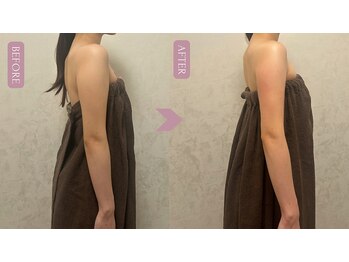 ブリス 渋谷駅前(BliSS)/ブライダル前の二の腕集中ケア