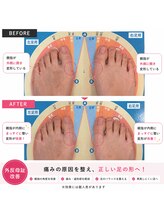 ふみらぼ 亀有/親指の変形をケア歩きやすい足へ