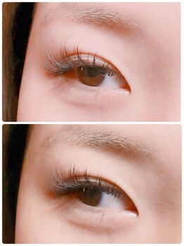 エタニティプラスアイラッシュアンドビューティー(Eternity+EyeLash&Beauty)/UPwardlash×フラットマット