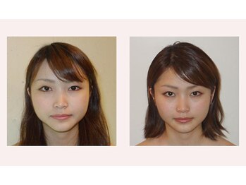 アゴラ/【小顔】豊富な施術実績有り