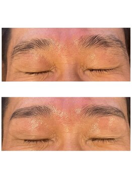 レヴィオ(REVIO)/ハリウッドブロウリフト