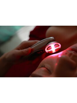 シミしわ改善！予防ケア