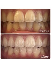 ビューティールームウィズ(beauty room w/)/beauty whitening!! 