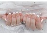 ◇チップ長さだし◆ カラーフレンチネイル　¥10900→¥9500