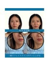 ハリラボ 仙台上杉店(hari Lab.)/【お客様の声】