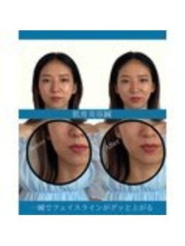 ハリラボ 仙台上杉店(hari Lab.)/【お客様の声】