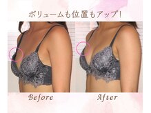 バストサロン メルベイユ(Merveile)