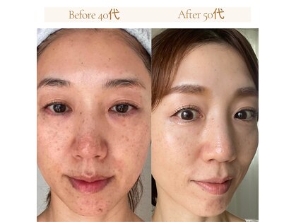 トータルエステティック ジョワイユ(JOYEUX)の写真
