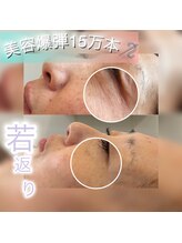 エースビューティー(Ace.Beauty)/vosサロンケア