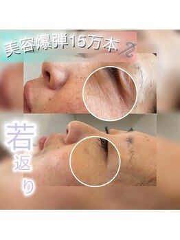 エースビューティー(Ace.Beauty)/vosサロンケア