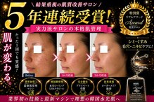ボーテヌール(Beaute Nheur)