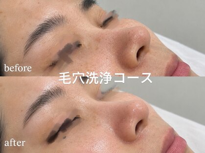 リベレスタ(liberesta)の写真