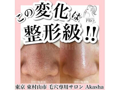 ビューティーサロン アカシャ(beauty salon Akasha)の写真