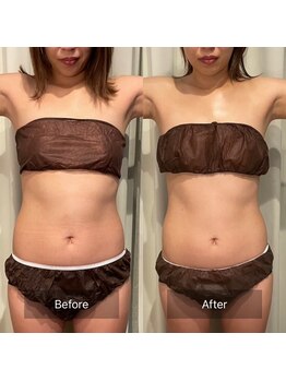 フフラ KANコルギセラピー山梨本店(fufla)/【ウルトランスフォーマー】