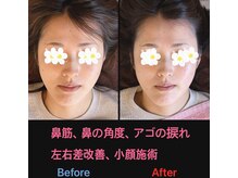 美容矯正サロン レレポノ(LELEPONO)/顎の捻じれ、鼻筋、歪み矯正