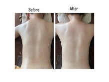 サロン アヌエヌエ アンド ポノ サロン(SalonAnuenue&pono_salon)の雰囲気（微弱電流によるオールハンドマッサージ♪首、肩こりや浮腫に◎）