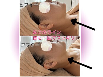 カリアンヌ/小顔/リフトアップ/むくみ改善