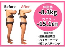 骨盤矯正×痩身マシン×栄養指導で自分史上最高ボディへ！