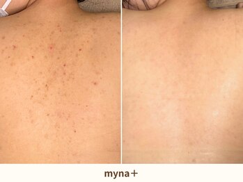 マイナプラ 表参道(myna+)/