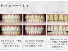 プティー(putih)の雰囲気（自分史上最高な美歯を♪メンズ利用も可です）