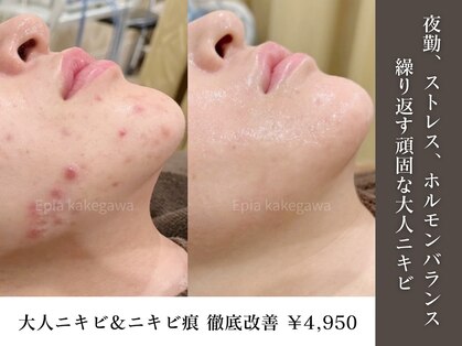 フェイシャル専門店 エピア 掛川店(Epia)の写真