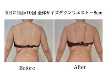 ナチュラーレ 天王寺店(Naturale)/痩身リンパマッサージ二の腕美脚