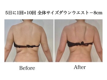 ナチュラーレ 天王寺店(Naturale)/痩身リンパマッサージ二の腕美脚