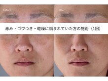 アイリス(iris)の雰囲気（肌質改善で、もっちり潤い素肌へ♪）