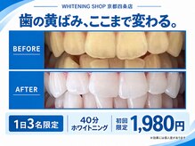ホワイトニングショップ 京都四条店