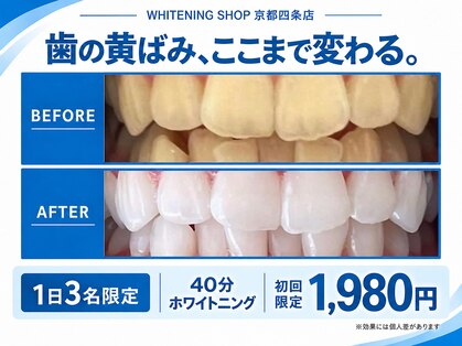ホワイトニングショップ 京都四条店の写真